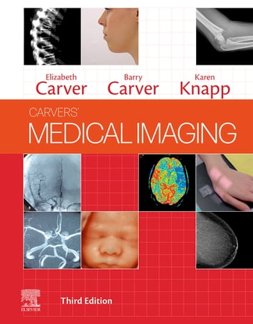 Medical Imaging - E-Book - BSc(Hons)  FAETC  DCRR Elizabeth Carver - PgDipCT  PGCE  DCRR Barry Carver - Karen Knapp