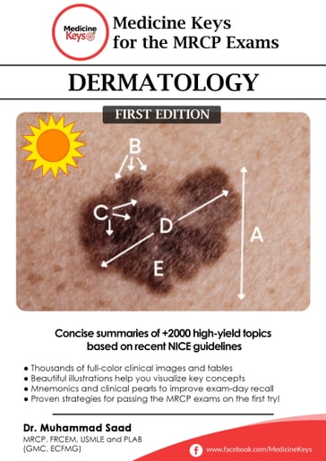 Medicine Keys for the MRCP Exams: Dermatology - Muhammad Elboghdady