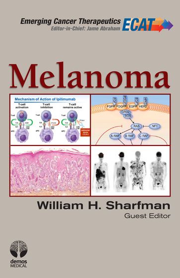 Melanoma - MD  FACP Jame Abraham - MD William H. Sharfman