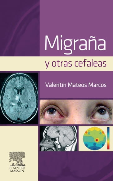 Migraña y otras cefaleas - Valentín Mateos Marcos