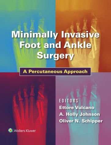 Minimally Invasive Foot and Ankle Surgery - Ettore Vulcano - Holly Johnson - Oliver Schipper