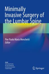Minimally Invasive Surgery of the Lumbar Spine