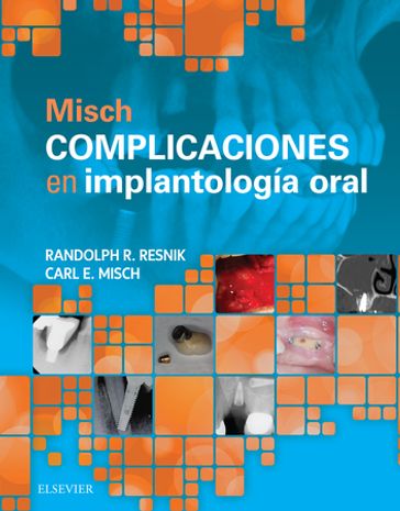 Misch. Complicaciones en implantología oral - DDS  MDS  PHD(HC) Carl E. Misch - DMD  MDS Randolph Resnik