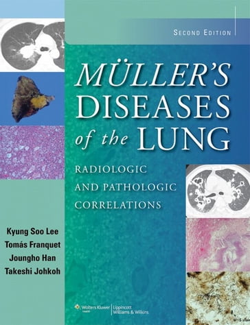 Muller's Diseases of the Lung - Joungho Han - Kyung Soo Lee - Takeshi Johkoh - Tomás Franquet