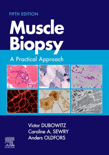 Muscle Biopsy E-Book - MD  PhD  FRCP  FRCPCH Victor Dubowitz - BSc  PhD  FRCPath Caroline A. Sewry - MD PhD Anders Oldfors