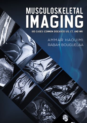 Musculoskeletal Imaging - AMMAR HAOUIMI