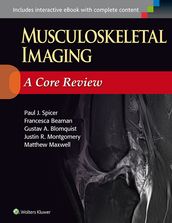 Musculoskeletal Imaging: A Core Review