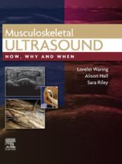 Musculoskeletal Ultrasound, E-Book