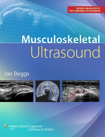 Musculoskeletal Ultrasound - Ian Beggs