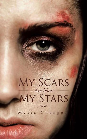 My Scars Are Now My Stars - Mysta Changes