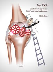 My TKR: One Patient s Experience With Total Knee Replacement