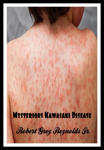 Mysterious Kawasaki Disease - Jr Robert Grey Reynolds