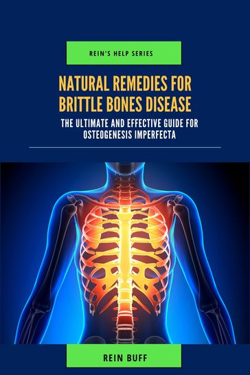 Natural Remedies for Brittle Bones Disease - Rein Buff