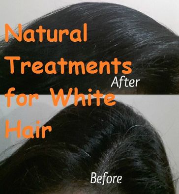 Natural Treatments for White Hair - VT