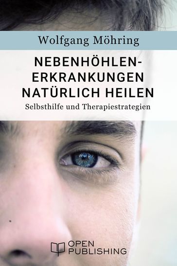 Nebenhöhlen-Erkrankungen natürlich heilen - Selbsthilfe und Therapiestrategien - Wolfgang Mohring