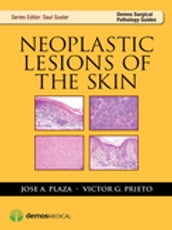 Neoplastic Lesions of the Skin