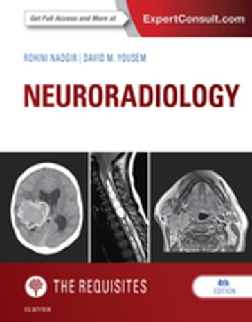 Neuroradiology: The Requisites E-Book - MD Rohini Nadgir - MD  MBA David M. Yousem