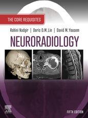 Neuroradiology: The Requisites