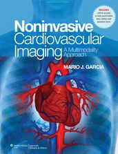 NonInvasive Cardiovascular Imaging: A Multimodality Approach