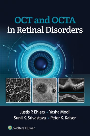 OCT and OCT Angiography in Retinal Disorders - Justis P. Ehlers