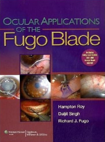 Ocular Applications of the Fugo Blade - Daljit Singh - F. Hampton Roy - Richard J. Fugo