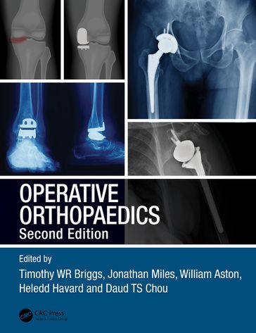 Operative Orthopaedics