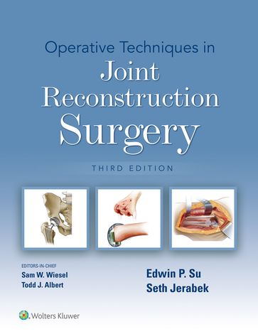 Operative Techniques in Joint Reconstruction Surgery - Edwin Su - Seth Jerabek