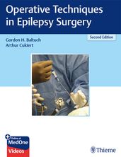 Operative Techniques in Epilepsy Surgery