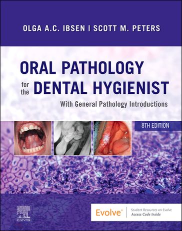 Oral Pathology for the Dental Hygienist E-Book - RDH  MS Olga A. C. Ibsen - DDS Scott Peters