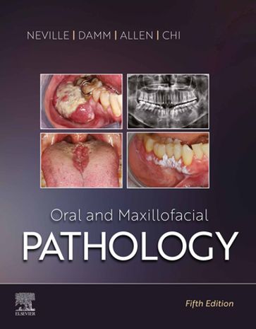 Oral and Maxillofacial Pathology - DDS Brad W. Neville - DDS Douglas D. Damm - DDS  MSD Carl M. Allen - DMD Angela C. Chi