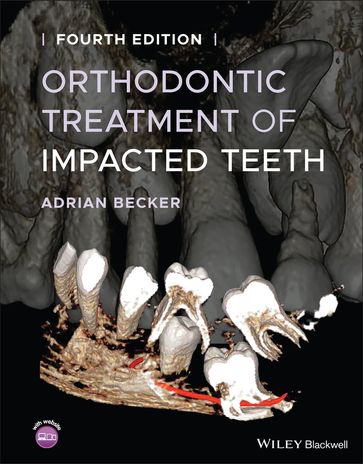 Orthodontic Treatment of Impacted Teeth - Adrian Becker