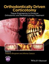 Orthodontically Driven Corticotomy