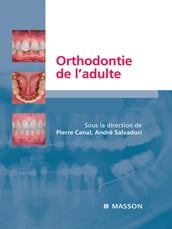 Orthodontie de l adulte