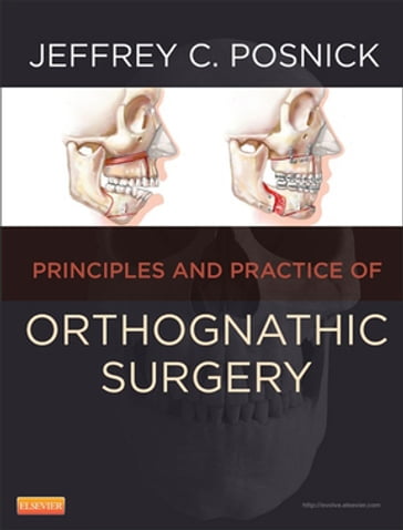 Orthognathic Surgery - Jeffrey C. Posnick - D.M.D. - M.D. - F.R.C.S. (C) - F.A.C.S.
