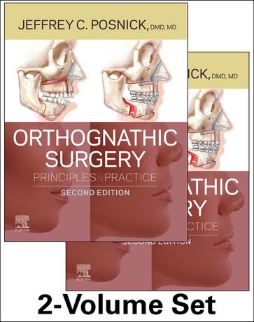 Orthognathic Surgery E-Book - Jeffrey C. Posnick - D.M.D. - M.D. - F.R.C.S. (C) - F.A.C.S.