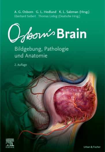 Osborn's Brain - Anne G. Osborn - Garry L. Hedlund - Karen L. Salzman