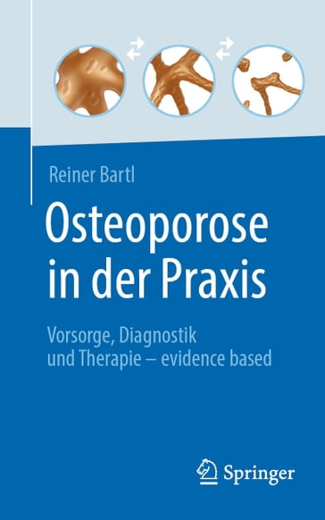 Osteoporose in der Praxis - Reiner Bartl