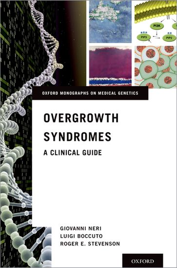 Overgrowth Syndromes - Giovanni Neri - Luigi Boccuto - Roger E. Stevenson