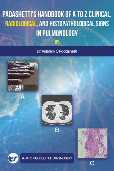 Padashetti's Textbook on A to Z Signs in Pulmonology - Dr vaibhav C Padashetti