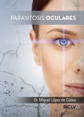 Parasitosis oculares