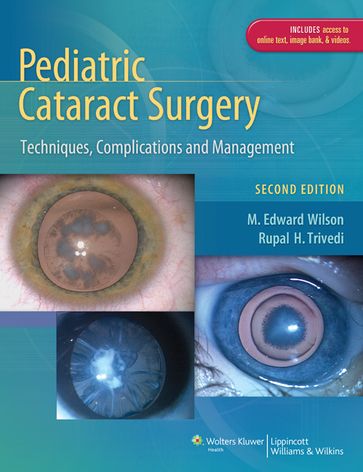 Pediatric Cataract Surgery - M. Edward Wilson - Rupal H. Trivedi