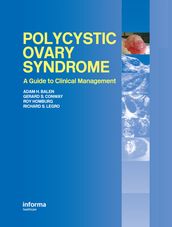 Polycystic Ovary Syndrome