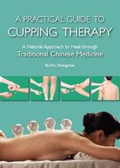 A Practical Guide to Cupping Therapy