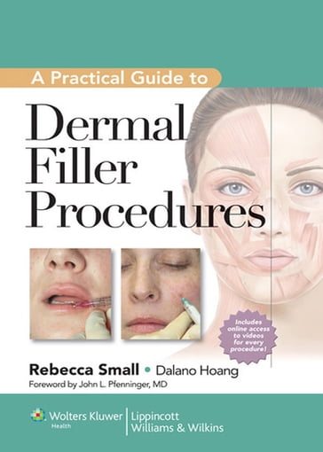 A Practical Guide to Dermal Filler Procedures - Dalano Hoang - Rebecca Small