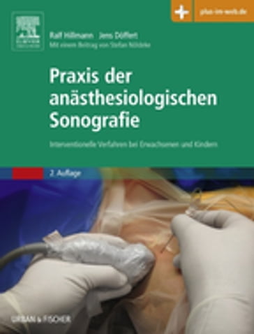 Praxis der anästhesiologischen Sonografie - Ralf Hillmann - Jens Doffert