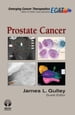 Prostate Cancer