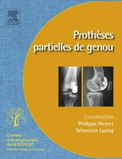 Prothèses partielles du genou