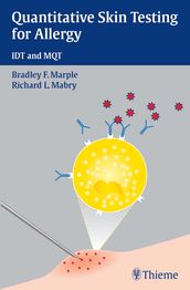 Quantitative Skin Testing for Allergy