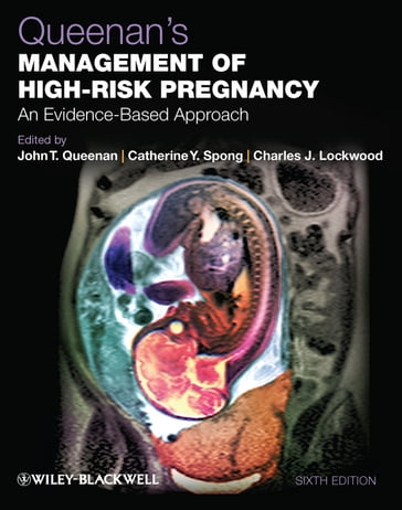 Queenan's Management of High-Risk Pregnancy - John T. Queenan - Catherine Y. Spong - Charles J. Lockwood