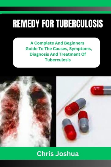 REMEDY FOR TUBERCULOSIS - Chris Joshua